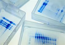 Request a quote online, Testing actual protein expression levels, and solubility